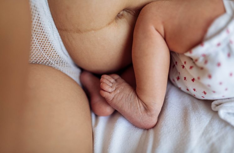 Efterfødsels-mave og nyfødt baby
